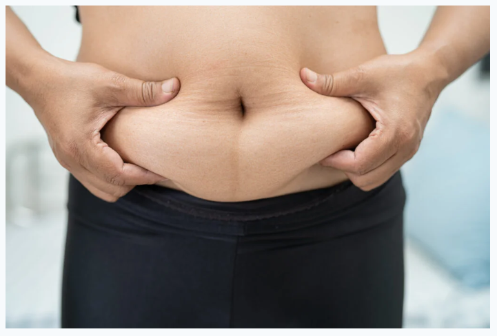 Stubborn belly fat example showing weight loss struggle explained in HoneyBurn review
